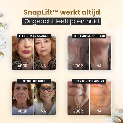 SnapLift